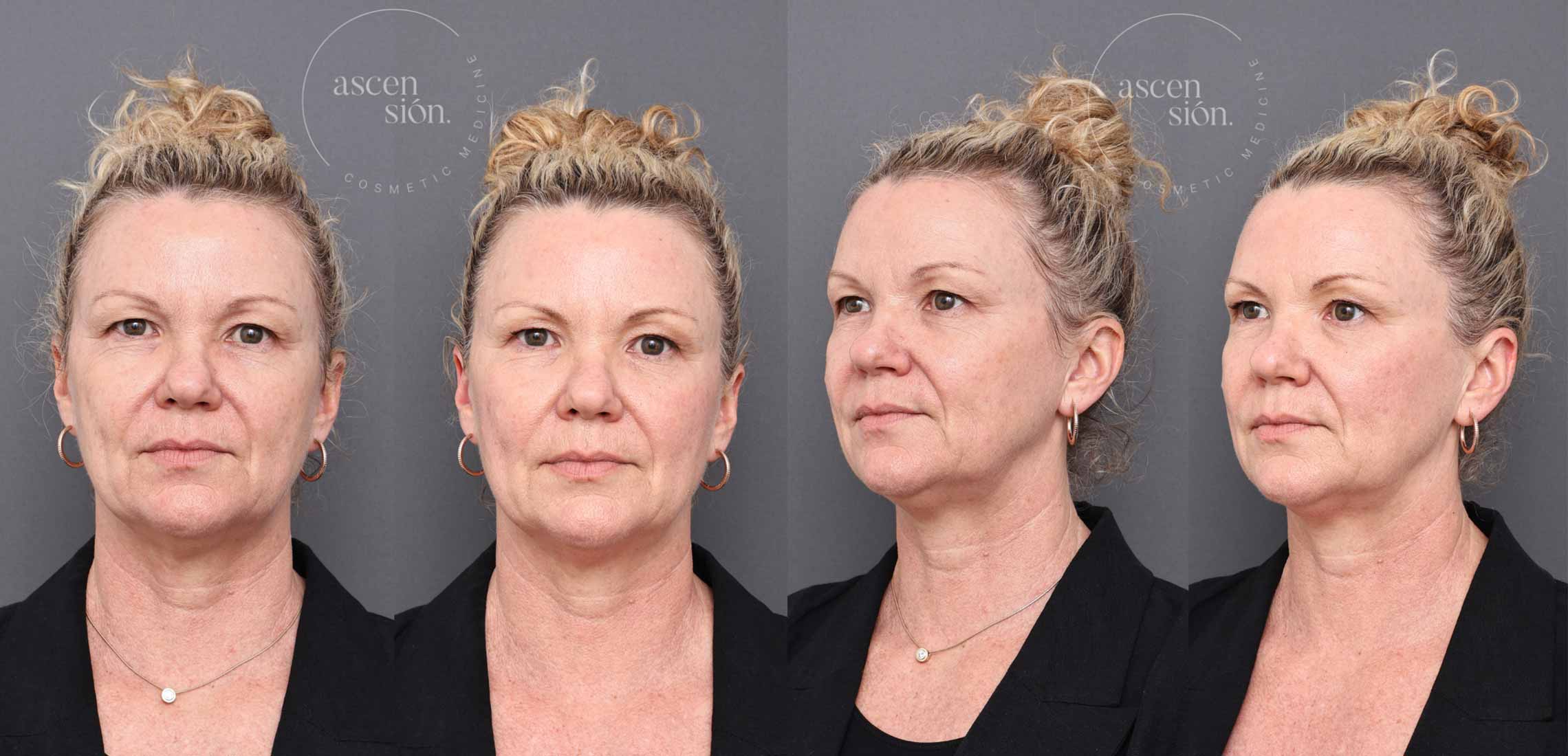 wonderface ascension cosmetic medicine